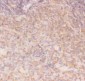 Anti-IKK Alpha Picoband Antibody